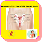 How to Recover your Vaginal size after Birth icône