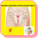 APK How to Recover your Vaginal size after Birth