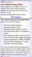 ECG Book पोस्टर