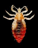 Head Lice guide poster