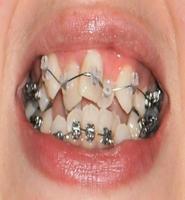 orthodontist guide poster