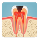 Dental Caries tips APK