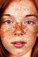 freckles tips 포스터