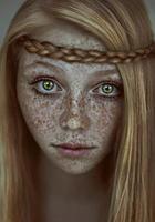freckles tips 스크린샷 1