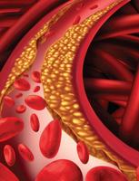 High Cholesterol capture d'écran 1