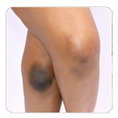 Bleaching the knees guide APK