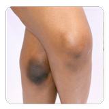 Bleaching the knees icon