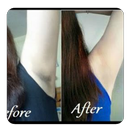 tips to get rid of dark armpit APK