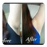tips to get rid of dark armpit icon