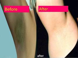 tips to get rid of dark armpit poster