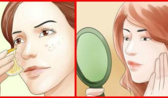 Home Remedies for Age Spots Ekran Görüntüsü 1