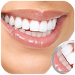 Whiten Teeth Instantly