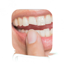 Broken Tooth no Pain Guide APK
