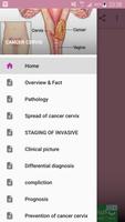 Cancer Cervix Fact 截图 2