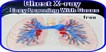 Chest X-ray Easy Guide