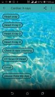 Cardiac X-rays Plakat