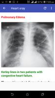 Cardiac X-rays Screenshot 1
