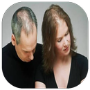 Hair loss APK