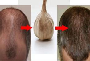 Hair loss اسکرین شاٹ 1