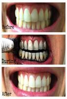Recipes for teeth whitening Affiche
