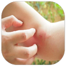 Home Remedies for Insect Bites APK