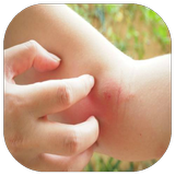 Home Remedies for Insect Bites icon