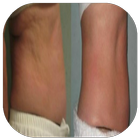 belly cellulite icon