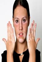 Natural cure for vitiligo poster