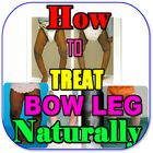 How To Fix Bow Legs Naturally 图标