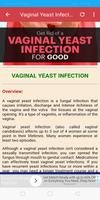 Vaginal Infections (All Information) تصوير الشاشة 3