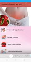 Vaginal Infections (All Information) الملصق
