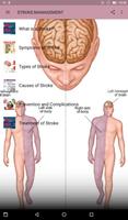 STROKE الملصق