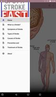 STROKE اسکرین شاٹ 1