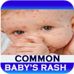 Baby's Rash Guide