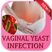 Vaginal Yeast Infection