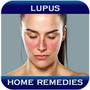 APK Home Remedies For Lupus
