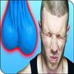 Blue Balls (Epididymal hypertension)