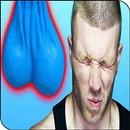 APK Blue Balls (Epididymal hypertension)