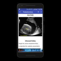 Obstetrics & Gyenacology Ultra syot layar 3