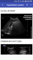 Abdomino-Pelvic Ultrasound постер