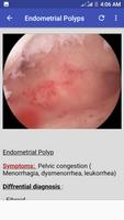 OSCE IN OBST & GYNAE পোস্টার