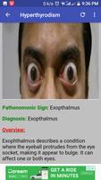 Pathognomonic Sign poster