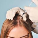 Mesotherapy For Hair Loss APK
