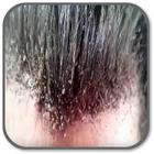 How to Get Rid of Lice ícone