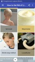 How to Get Rid of Lice Cartaz