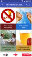 How to Prevent Gallstones Cartaz