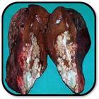 How to Prevent Hepatitis C আইকন