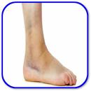 How to Treat Swelling APK