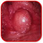 How to Treat Vaginal Cysts أيقونة