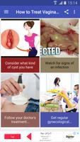 پوستر How to Treat Vaginal Cysts